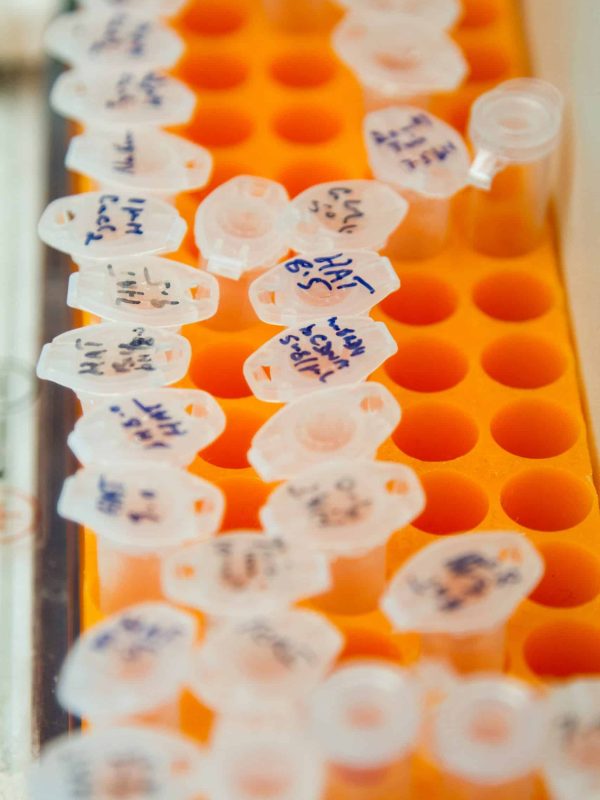 provette medicali per analisi. Il mondo HLS è in rapida evoluzione; da un lato persistono aspetti di regolamentazione rigorosa del mercato, di focus su qualità e sicurezza